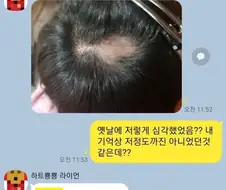 탈모가 고민인 친구