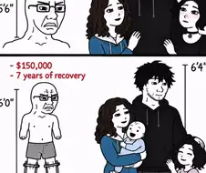 한국보다 3배는 심한 서구의 키정병