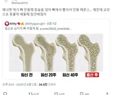 임신하면 여자 뼈가 만화진다는 사진의 진실.manga