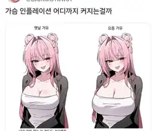 젖플레인
