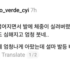 그저께 넘어졌는데 발이 엄청 붓네....jpg